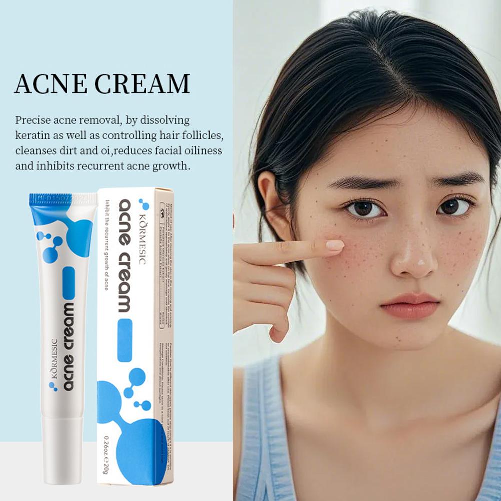 ครีมกำจัดสิว 20% Azelaic Acid  - Luxury Skincare Brands บทวิจารณ์และราคา